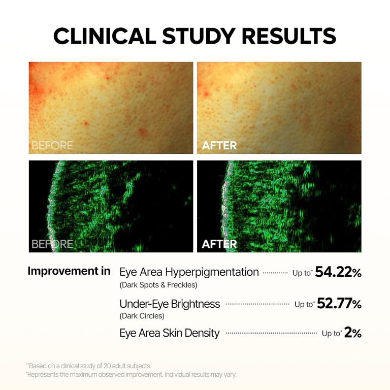 Dr. Melaxin TX-Kojic Acid Retinal Eye Patch