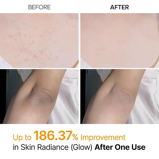 Dr. Melaxin Peel Shot Exfoliating Spray – Body & Foot