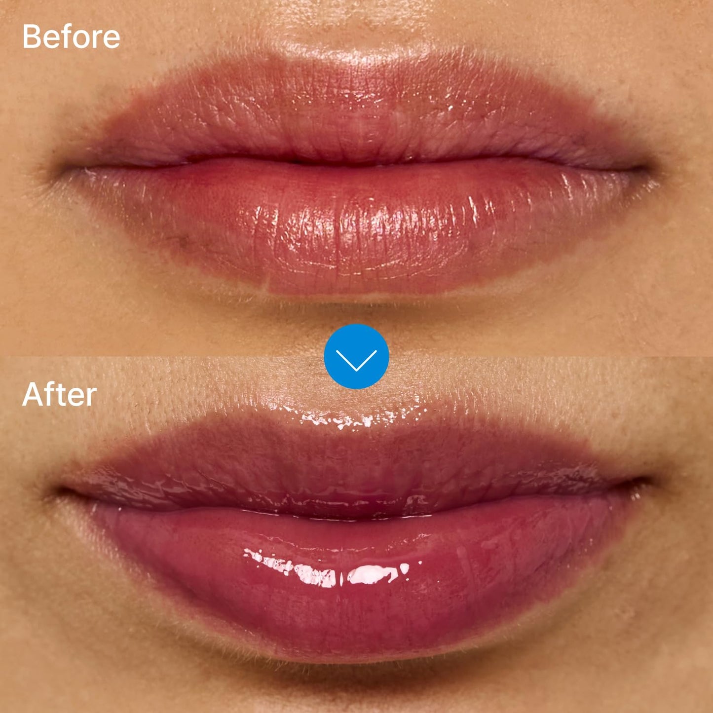 Fwee lips