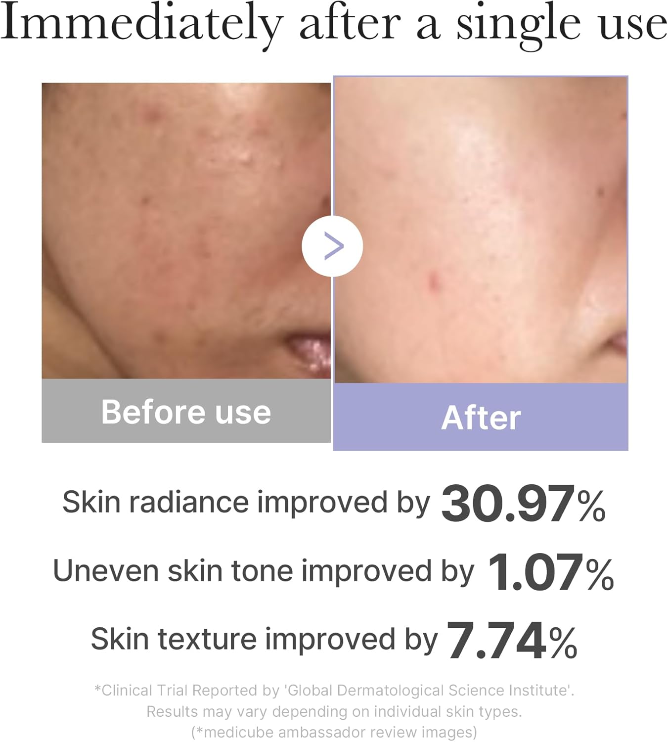 skincare device