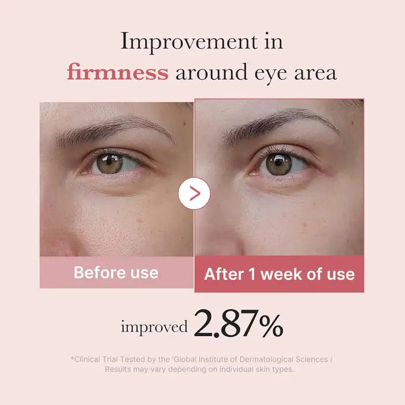 Firming and brightening eye cream with collagen-boosting PDRN – best for tired eyes in Kuwait