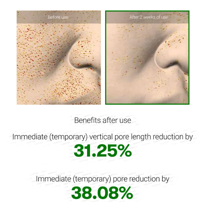 VT Reedle Shot 100 sensitive skin