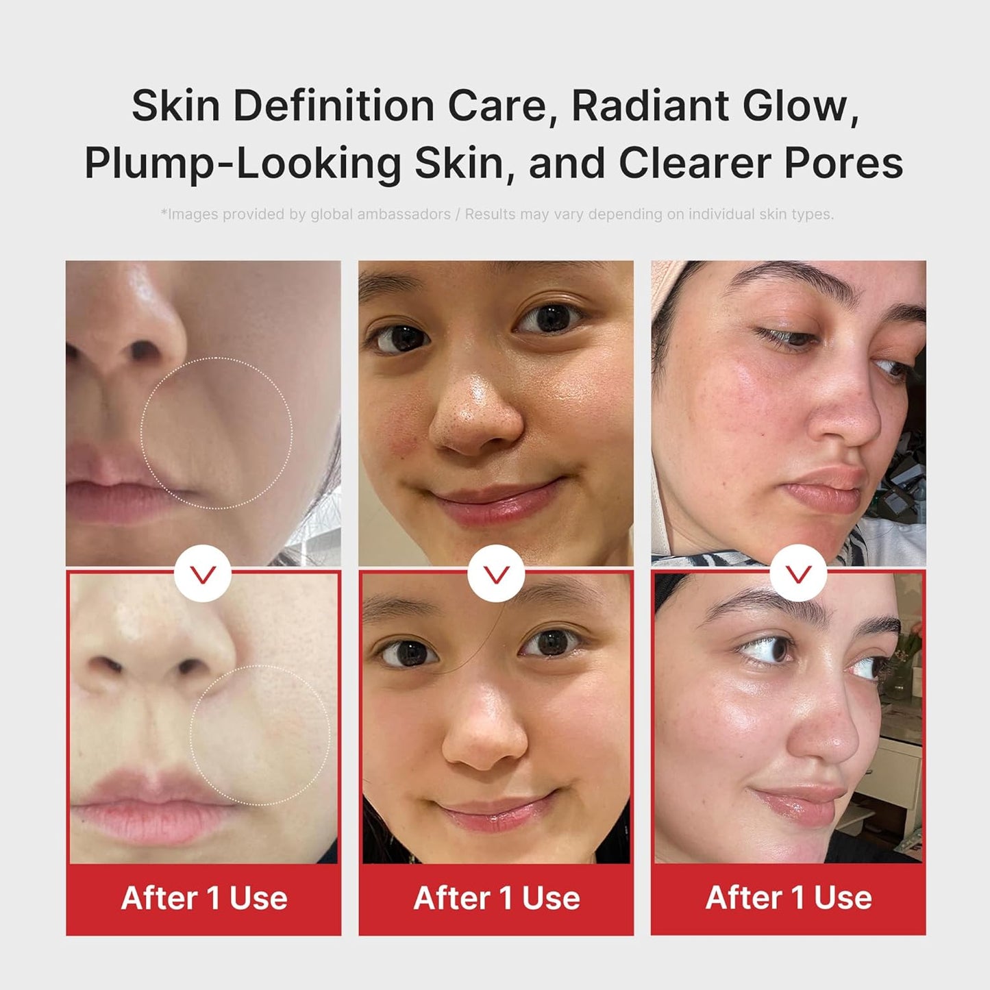 Medicube AGE-R Booster Pro (Pink)