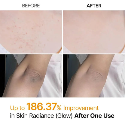 Dr. Melaxin Peel Shot Exfoliating Spray – Body & Foot