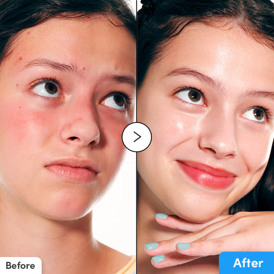 EQQUALBERRY Serum