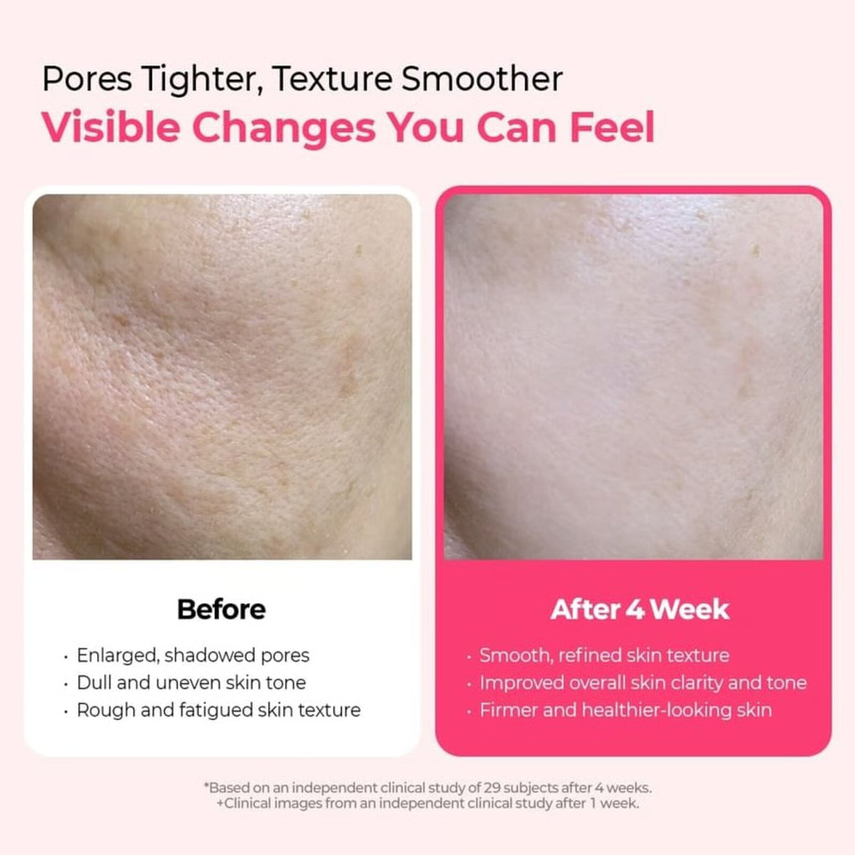 Dr. Melaxin – Cemenrete Cyano Pink Spicule Serum 30ml